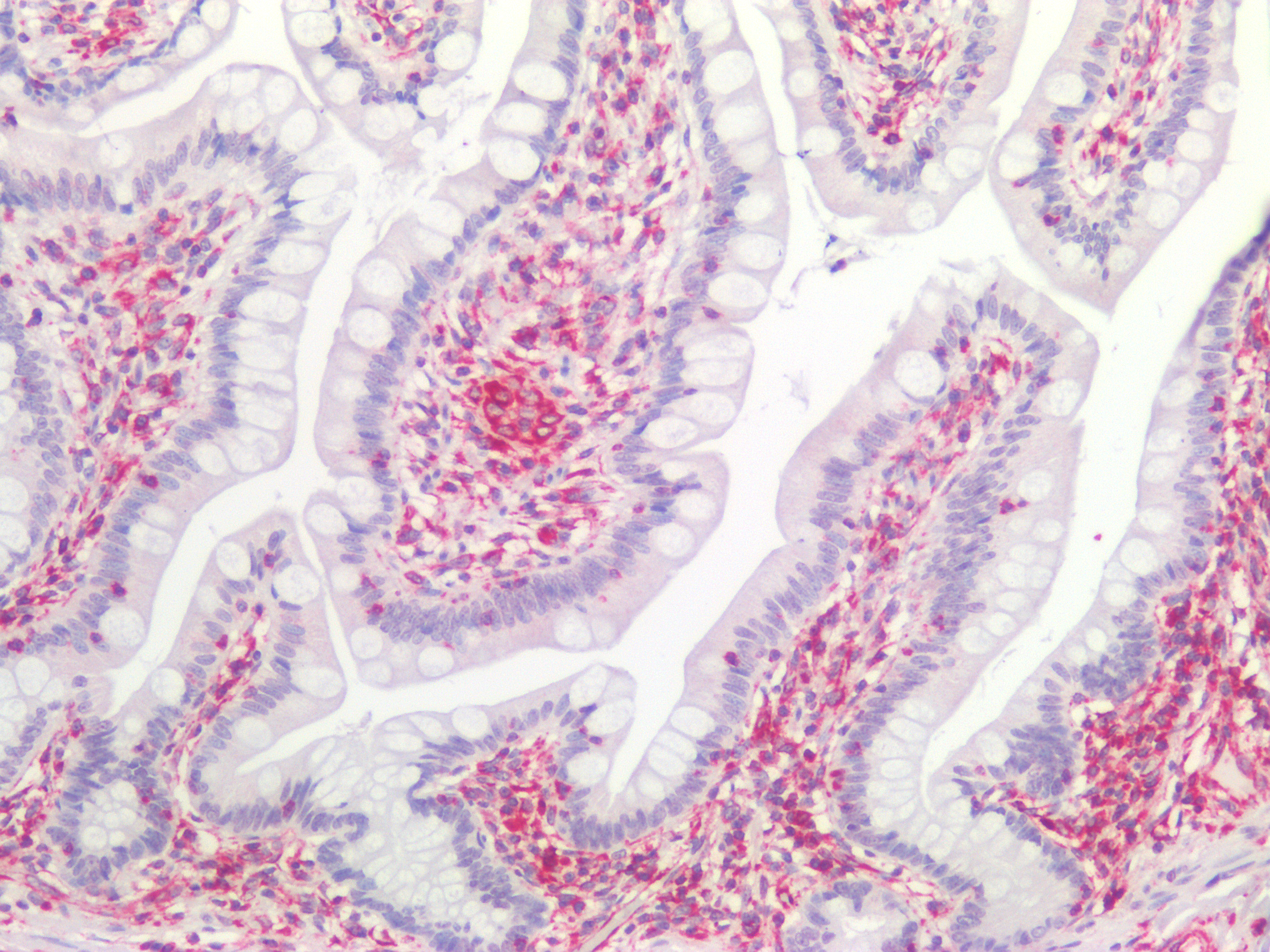 Figure 8. Immunostaining of human paraffin embedded tissue sections of human small intestine with MUB1903P (diluted 1:100), showing the specific pattern of vimentin in the mesenchymal cell types, such as fibroblasts in the connective tissue. As expected, no reactivity is seen in the epithelial cell compartment.